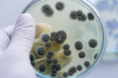 Penicillium 'un geçmişi, gıda ve uyuşturucu üretiminin yanı sıra petri kabında ascomycetous.