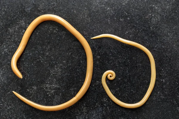 Ascariasis, parazit yuvarlak kurt Ascaris lumbrikoidlerinin laboratuarlarda eğitim için neden olduğu bir hastalıktır..