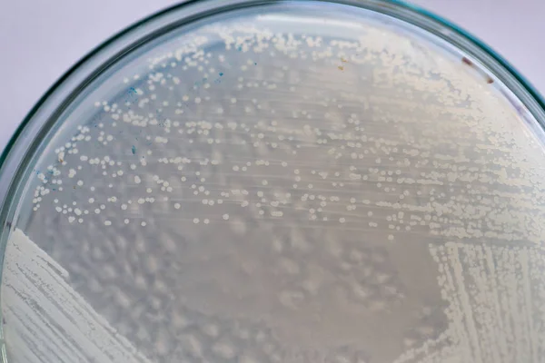 Levedura Placa Petri Microbiologia Para Educação Laboratórios — Fotografia de Stock