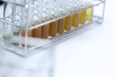 Agaroz jel elektroforez, biyokimya, moleküler biyoloji, genetik ve klinik kimyada kullanılan bir jel elektroforez metodudur.