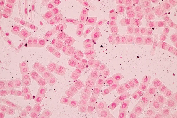 顕微鏡下のタマネギの根先にあるタマネギとミトシス細胞の根先 — ストック写真