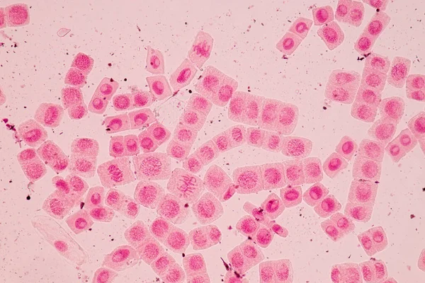 Punta Raíz Cebolla Mitosis Punta Raíz Cebolla Bajo Microscopio — Foto de Stock