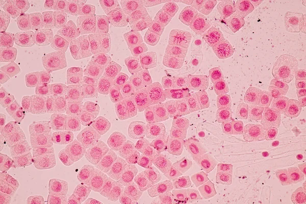 Punta Raíz Cebolla Mitosis Punta Raíz Cebolla Bajo Microscopio — Foto de Stock