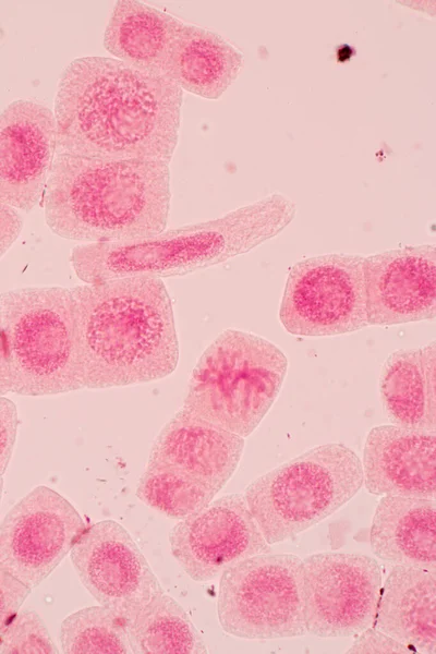 Extrémité Racinaire Oignon Cellule Mitose Dans Extrémité Racinaire Oignon Sous — Photo
