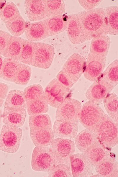 Root tip of Onion and Mitosis cell in the Root tip of Onion under a microscope.