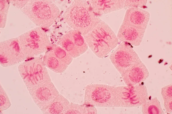 Ponta Raiz Célula Cebola Mitose Ponta Raiz Cebola Sob Microscópio — Fotografia de Stock