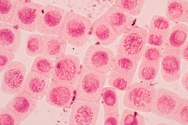 Root tip of Onion and Mitosis cell in the Root tip of Onion under a microscope.