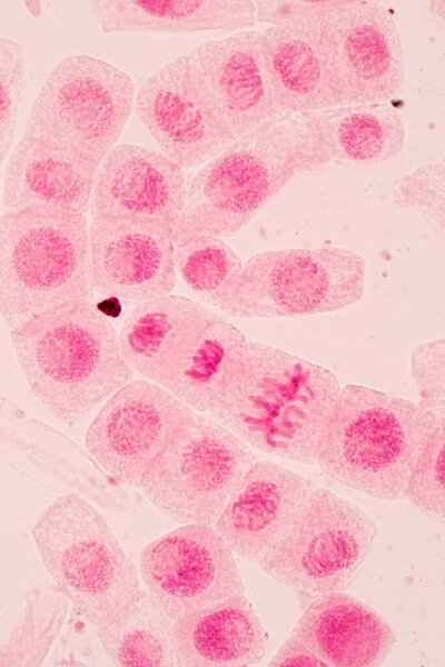 Root tip of Onion and Mitosis cell in the Root tip of Onion under a microscope.