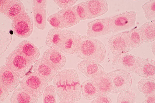 Root tip of Onion and Mitosis cell in the Root tip of Onion under a microscope.