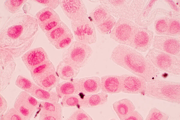 Root tip of Onion and Mitosis cell in the Root tip of Onion under a microscope.