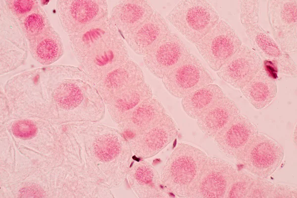 Hagyma Mitózis Sejt Gyökércsúcsa Hagyma Gyökércsúcsán Mikroszkóp Alatt — Stock Fotó