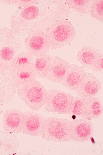 Punta Raíz Cebolla Mitosis Punta Raíz Cebolla Bajo Microscopio — Foto de Stock