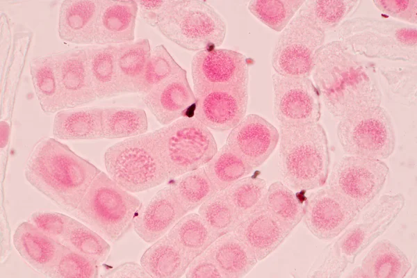 Punta Raíz Cebolla Mitosis Punta Raíz Cebolla Bajo Microscopio —  Fotos de Stock