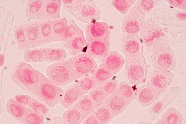 Root tip of Onion and Mitosis cell in the Root tip of Onion under a microscope.