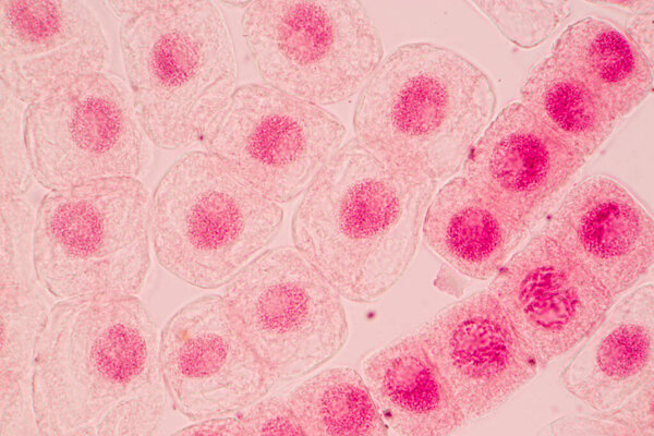 Root tip of Onion and Mitosis cell in the Root tip of Onion under a microscope.