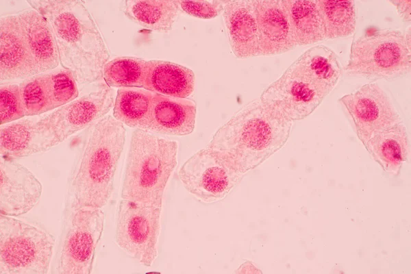 Špička Kořenové Cibule Mitózy Kořenové Špičce Cibule Pod Mikroskopem — Stock fotografie