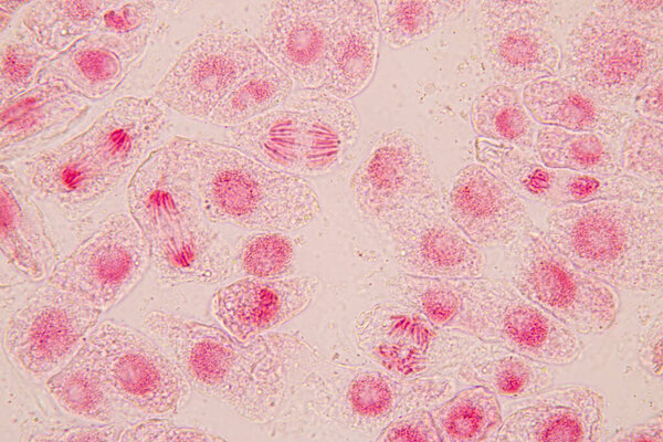 Root tip of Onion and Mitosis cell in the Root tip of Onion under a microscope.