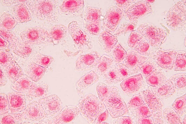 Punta Raíz Cebolla Mitosis Punta Raíz Cebolla Bajo Microscopio — Foto de Stock