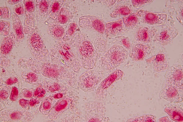 Punta Raíz Cebolla Mitosis Punta Raíz Cebolla Bajo Microscopio — Foto de Stock