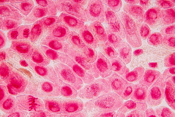 Root tip of Onion and Mitosis cell in the Root tip of Onion under a microscope.