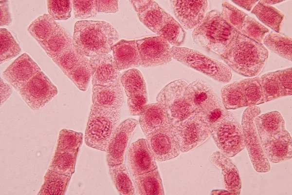 显微镜下洋葱根尖中洋葱和有丝分裂细胞的根尖 — 图库照片