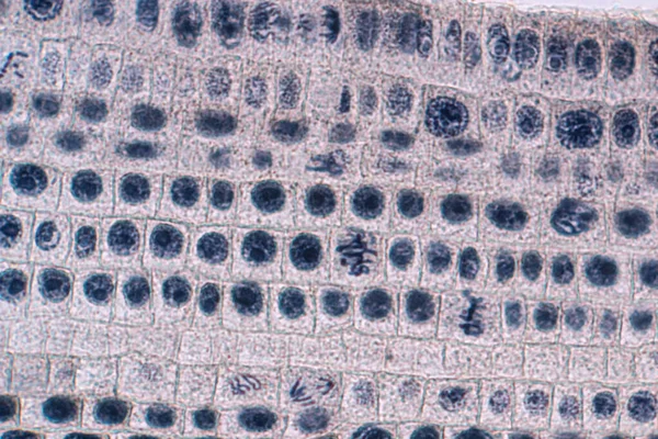 顕微鏡下のタマネギの根先にあるタマネギとミトシス細胞の根先 — ストック写真