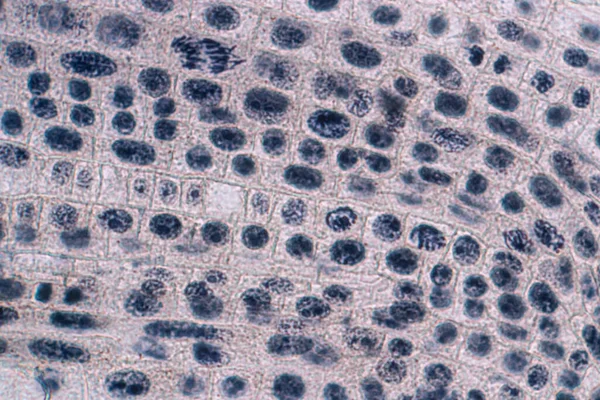 Punta Raíz Cebolla Mitosis Punta Raíz Cebolla Bajo Microscopio — Foto de Stock