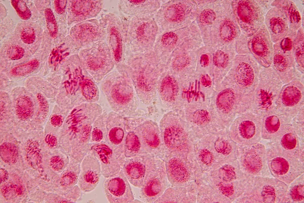 顕微鏡下のタマネギの根先にあるタマネギとミトシス細胞の根先 — ストック写真
