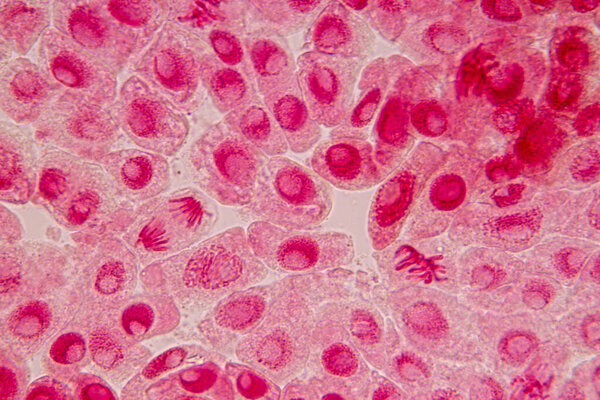 Root tip of Onion and Mitosis cell in the Root tip of Onion under a microscope.