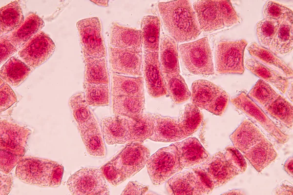 Ρίζα Του Κυττάρου Κρεμμύδι Και Μίτωση Στο Ρίζα Του Κρεμμύδι — Φωτογραφία Αρχείου