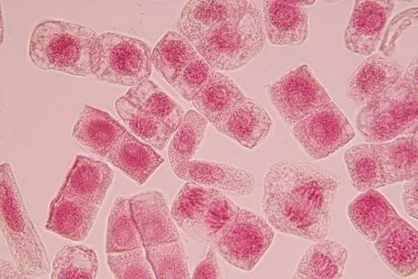 Wortelpunt Van Uien Mitosecel Wortelpunt Van Onder Een Microscoop — Stockfoto