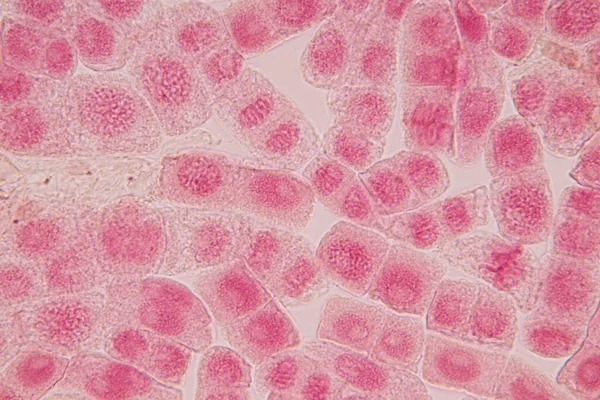 Rotspetsen Lök Och Mitos Cell Rotspetsen Lök Ett Mikroskop — Stockfoto