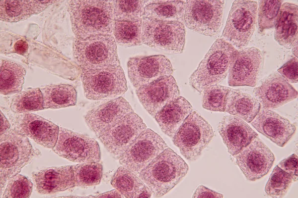 Wortelpunt Van Uien Mitosecel Wortelpunt Van Onder Een Microscoop — Stockfoto