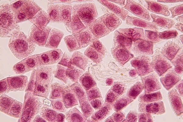 Punta Raíz Cebolla Mitosis Punta Raíz Cebolla Bajo Microscopio — Foto de Stock