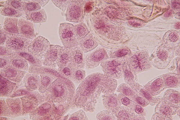 Root tip of Onion and Mitosis cell in the Root tip of Onion under a microscope.