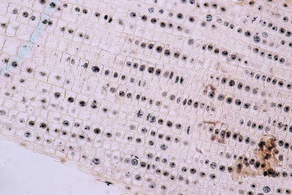 Ponta Raiz Célula Cebola Mitose Ponta Raiz Cebola Sob Microscópio — Fotografia de Stock