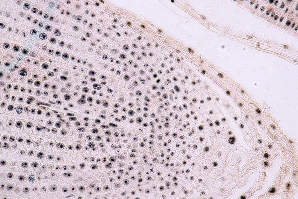 Punta Raíz Cebolla Mitosis Punta Raíz Cebolla Bajo Microscopio — Foto de Stock