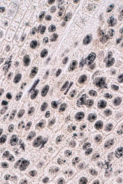 Ponta Raiz Célula Cebola Mitose Ponta Raiz Cebola Sob Microscópio — Fotografia de Stock