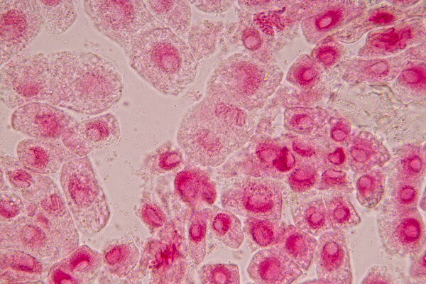 Root tip of Onion and Mitosis cell in the Root tip of Onion under a microscope.