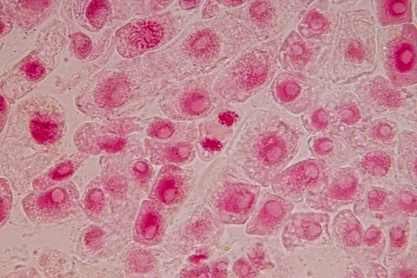 Punta Raíz Cebolla Mitosis Punta Raíz Cebolla Bajo Microscopio —  Fotos de Stock