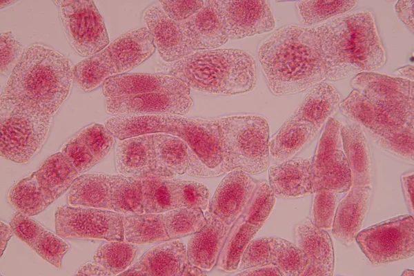 Rotspetsen Lök Och Mitos Cell Rotspetsen Lök Ett Mikroskop — Stockfoto