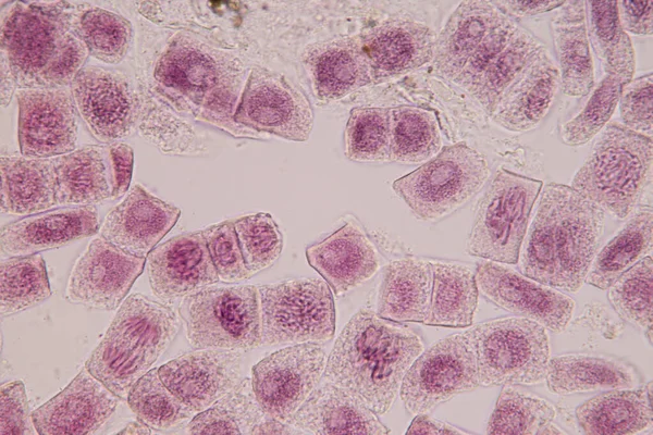 Hagyma Mitózis Sejt Gyökércsúcsa Hagyma Gyökércsúcsán Mikroszkóp Alatt — Stock Fotó