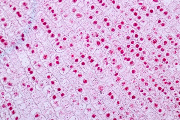 Wortelpunt Van Uien Mitosecel Wortelpunt Van Onder Een Microscoop — Stockfoto