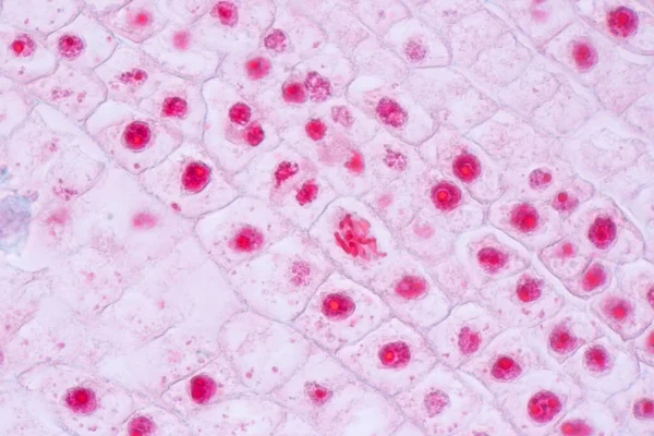 Soğanın Kökündeki Soğan Mitoz Hücresinin Kök Ucu Mikroskop Altında — Stok fotoğraf