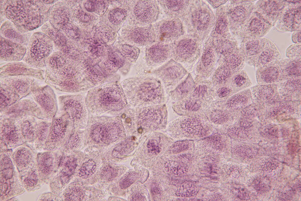 Root tip of Onion and Mitosis cell in the Root tip of Onion under a microscope.