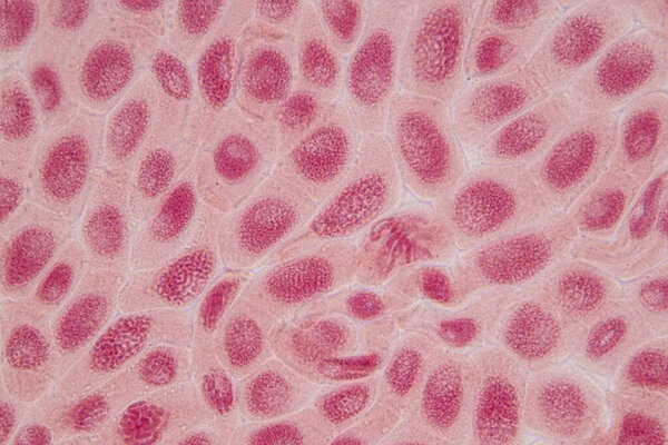 Root tip of Onion and Mitosis cell in the Root tip of Onion under a microscope.