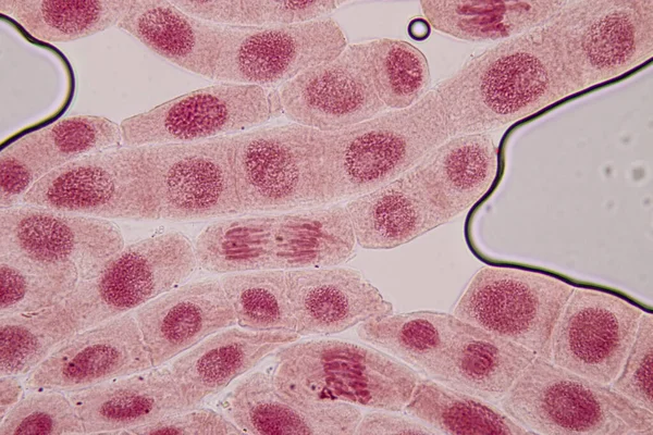 显微镜下洋葱根尖中洋葱和有丝分裂细胞的根尖 — 图库照片