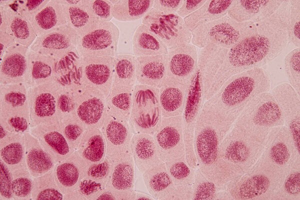 Root tip of Onion and Mitosis cell in the Root tip of Onion under a microscope.