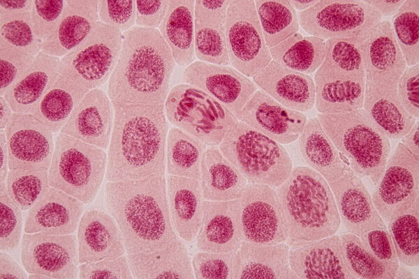 Root tip of Onion and Mitosis cell in the Root tip of Onion under a microscope.