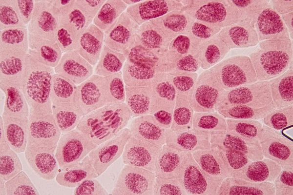 Extrémité Racinaire Oignon Cellule Mitose Dans Extrémité Racinaire Oignon Sous — Photo